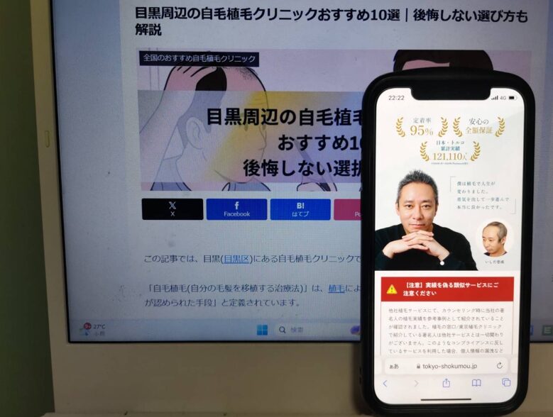 目黒周辺の自毛植毛クリニックおすすめ10選｜後悔しない選び方も解説