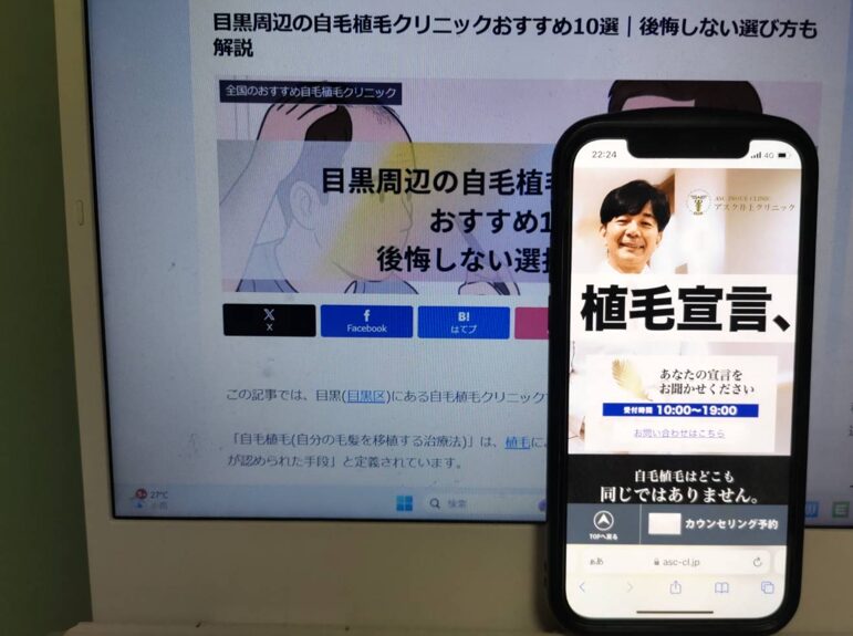 目黒周辺の自毛植毛クリニックおすすめ10選｜後悔しない選び方も解説