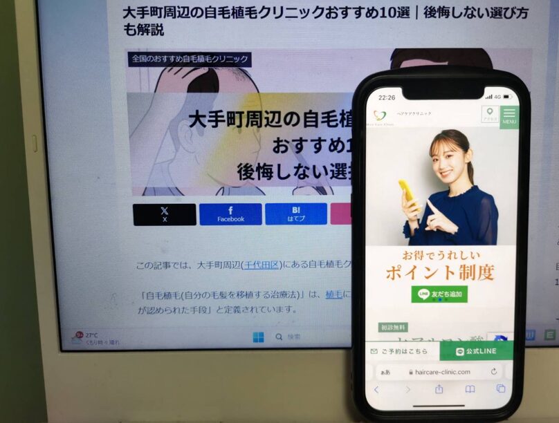 大手町周辺の自毛植毛クリニックおすすめ10選｜後悔しない選び方も解説