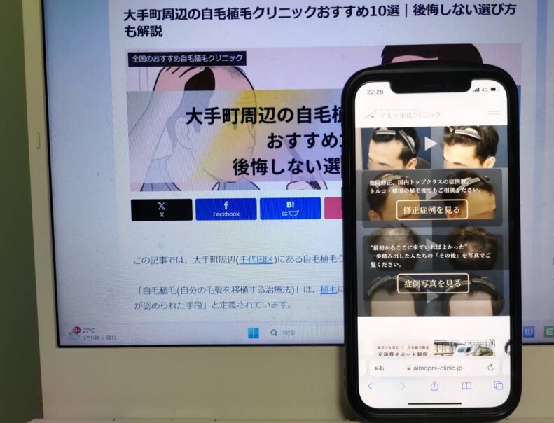 大手町周辺の自毛植毛クリニックおすすめ10選｜後悔しない選び方も解説