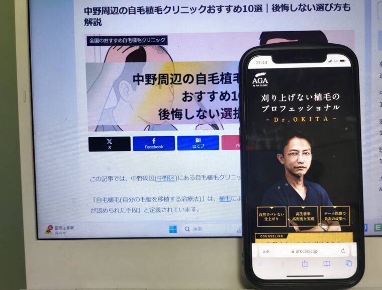 中野周辺の自毛植毛クリニックおすすめ10選｜後悔しない選び方も解説
