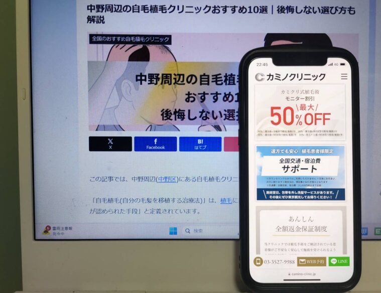 中野周辺の自毛植毛クリニックおすすめ10選｜後悔しない選び方も解説