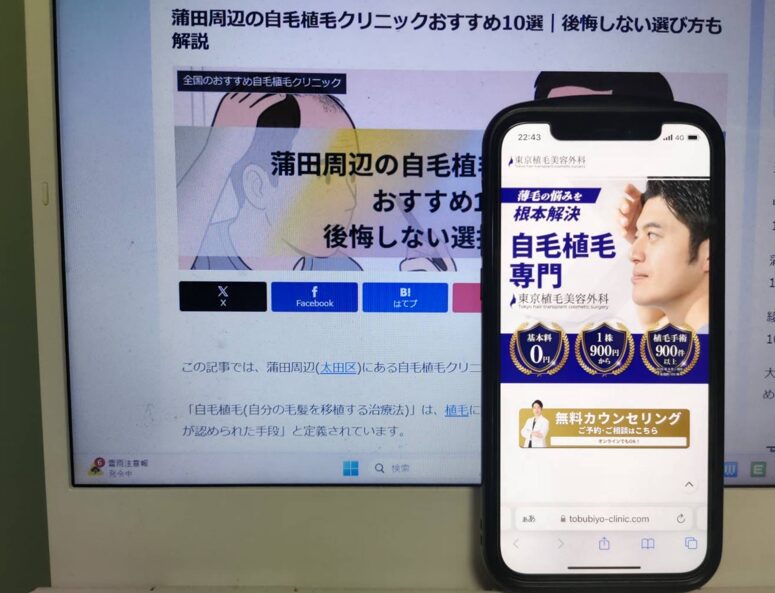 蒲田周辺の自毛植毛クリニックおすすめ10選｜後悔しない選び方も解説