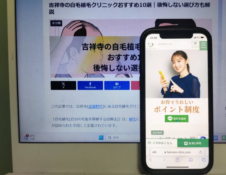 吉祥寺の自毛植毛クリニックおすすめ10選｜後悔しない選び方も解説