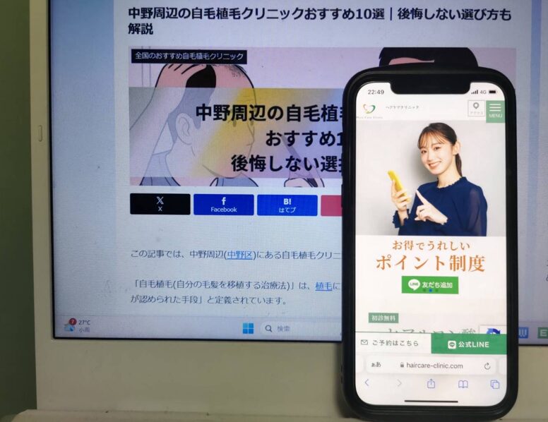 中野周辺の自毛植毛クリニックおすすめ10選｜後悔しない選び方も解説