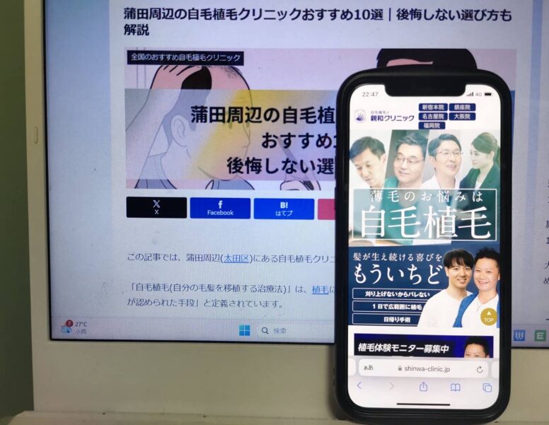 蒲田周辺の自毛植毛クリニックおすすめ10選｜後悔しない選び方も解説