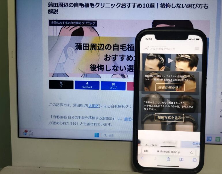 蒲田周辺の自毛植毛クリニックおすすめ10選｜後悔しない選び方も解説