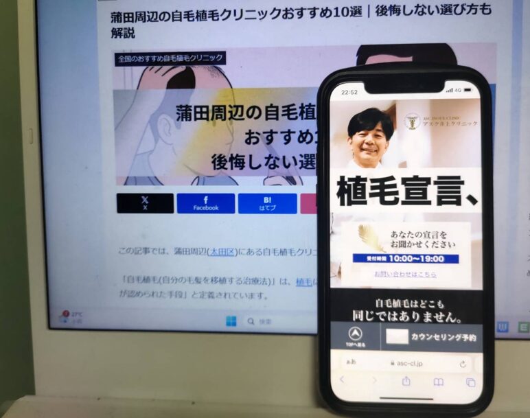 蒲田周辺の自毛植毛クリニックおすすめ10選｜後悔しない選び方も解説