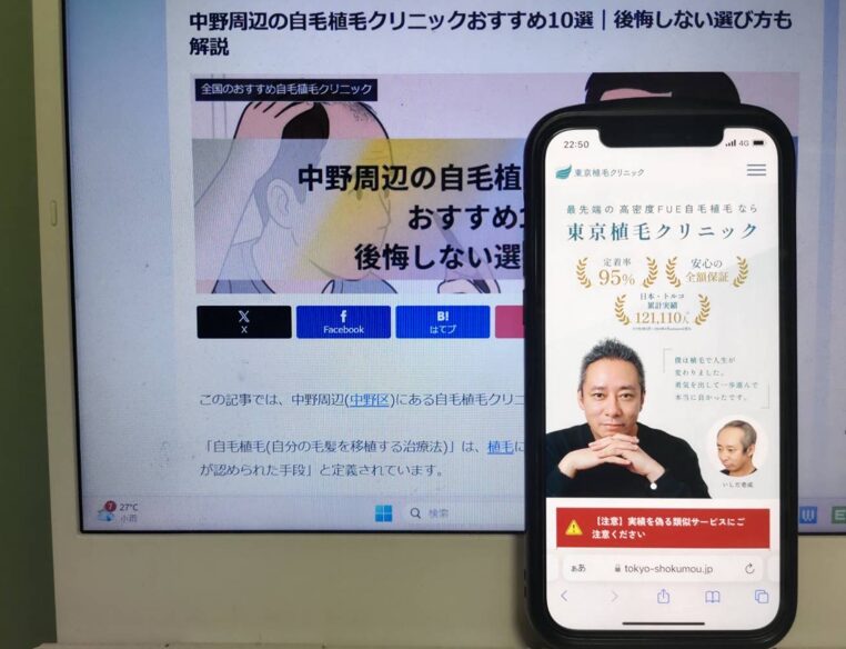 中野周辺の自毛植毛クリニックおすすめ10選｜後悔しない選び方も解説
