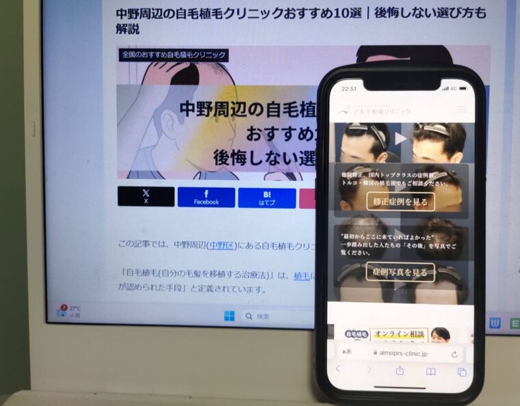 中野周辺の自毛植毛クリニックおすすめ10選｜後悔しない選び方も解説