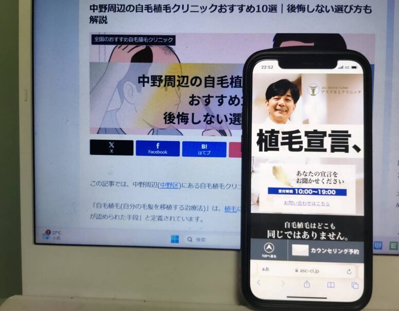 中野周辺の自毛植毛クリニックおすすめ10選｜後悔しない選び方も解説