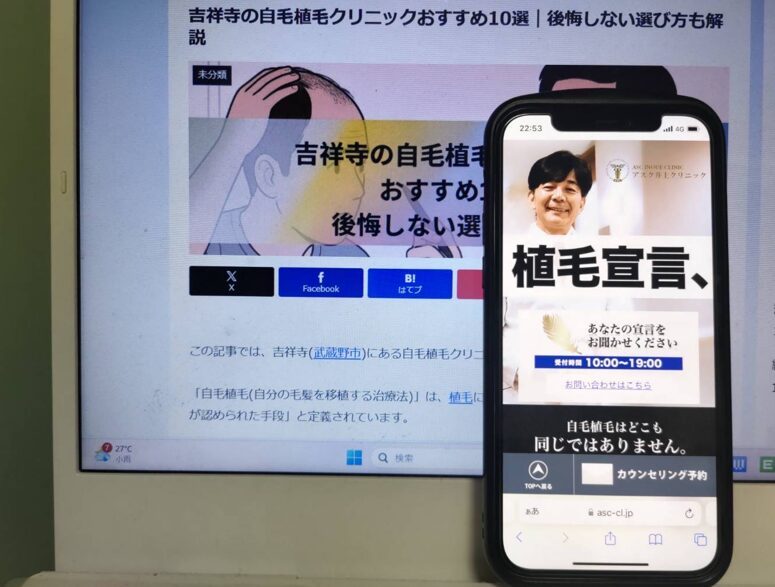 吉祥寺の自毛植毛クリニックおすすめ10選｜後悔しない選び方も解説