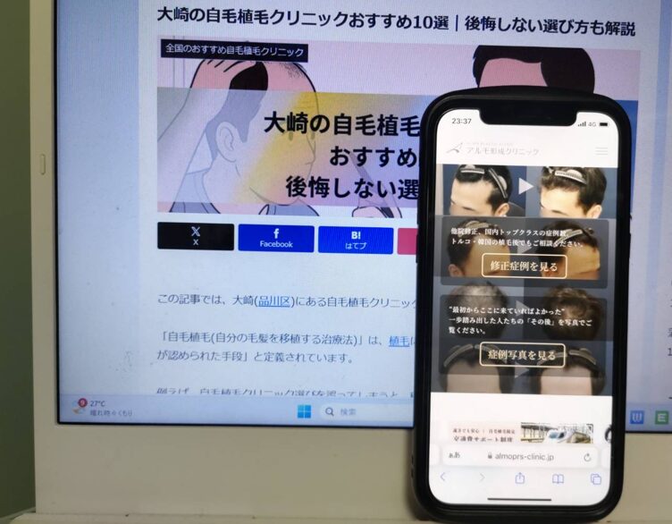 大崎の自毛植毛クリニックおすすめ10選｜後悔しない選び方も解説