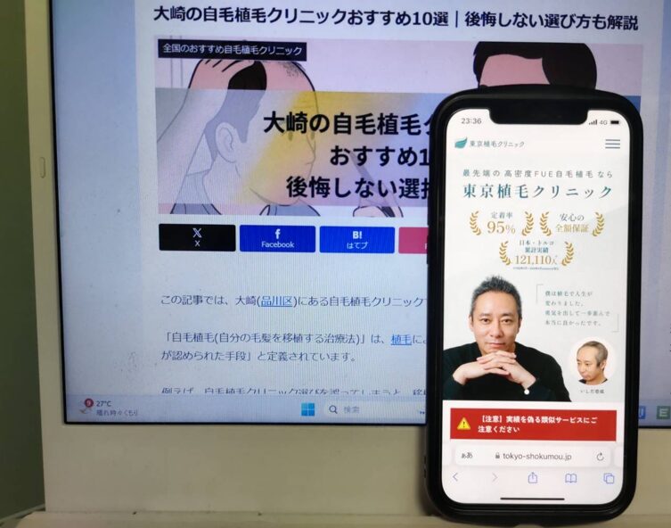 大崎の自毛植毛クリニックおすすめ10選｜後悔しない選び方も解説