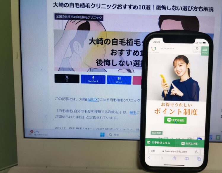 大崎の自毛植毛クリニックおすすめ10選｜後悔しない選び方も解説