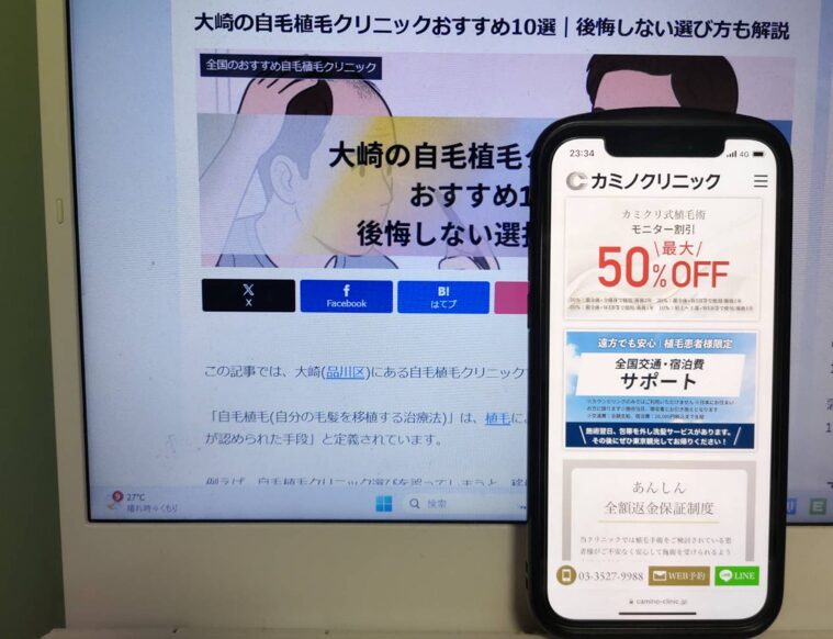 大崎の自毛植毛クリニックおすすめ10選｜後悔しない選び方も解説