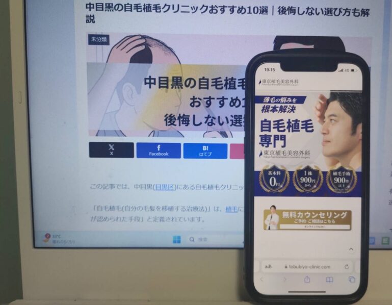 中目黒の自毛植毛クリニックおすすめ10選｜後悔しない選び方も解説