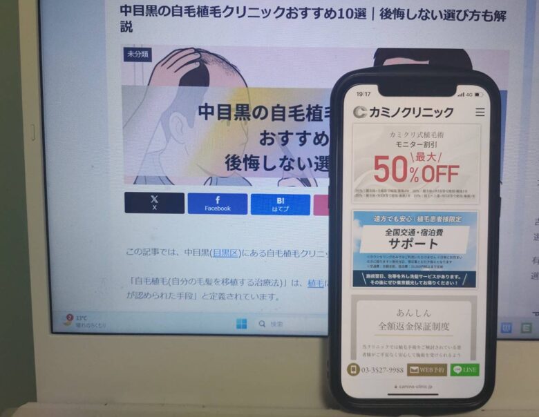 中目黒の自毛植毛クリニックおすすめ10選｜後悔しない選び方も解説