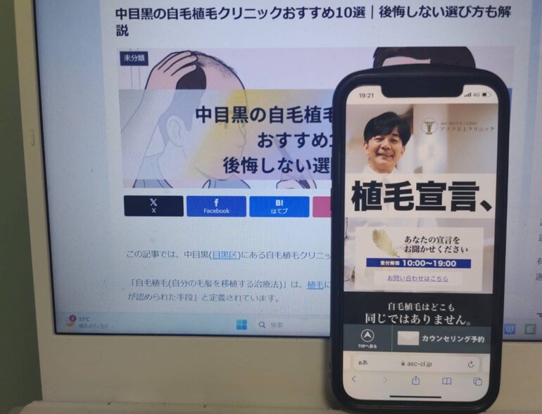 中目黒の自毛植毛クリニックおすすめ10選｜後悔しない選び方も解説
