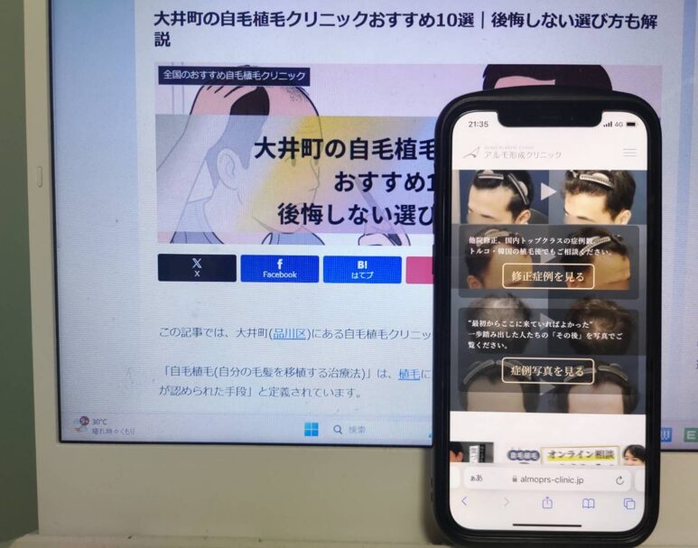 大井町の自毛植毛クリニックおすすめ10選｜後悔しない選び方も解説