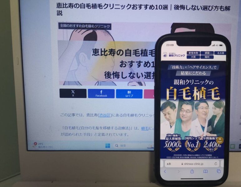 恵比寿の自毛植毛クリニックおすすめ10選｜後悔しない選び方も解説