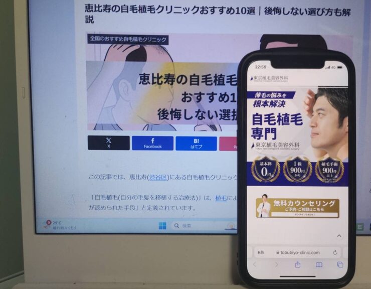恵比寿の自毛植毛クリニックおすすめ10選｜後悔しない選び方も解説