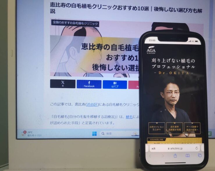 恵比寿の自毛植毛クリニックおすすめ10選｜後悔しない選び方も解説