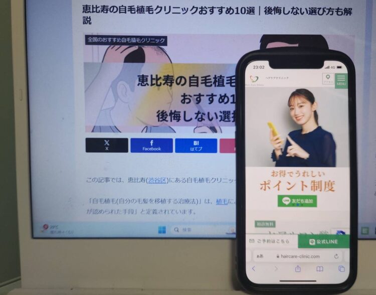 恵比寿の自毛植毛クリニックおすすめ10選｜後悔しない選び方も解説