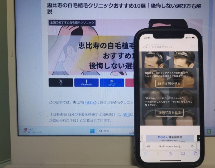恵比寿の自毛植毛クリニックおすすめ10選｜後悔しない選び方も解説