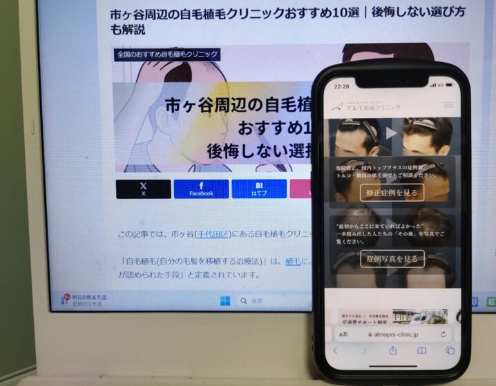 市ヶ谷周辺の自毛植毛クリニックおすすめ10選｜後悔しない選び方も解説
