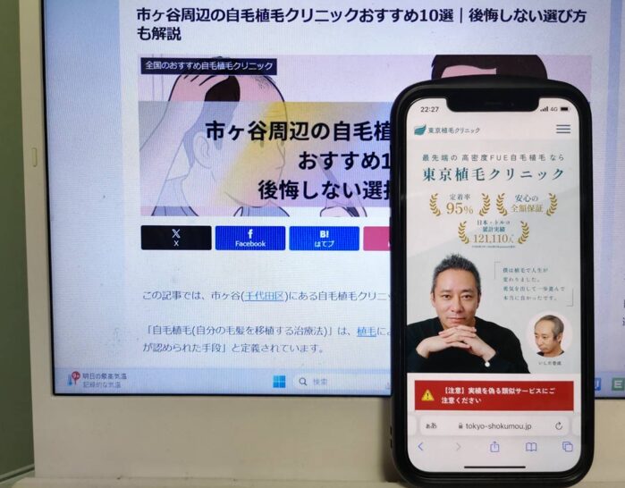 市ヶ谷周辺の自毛植毛クリニックおすすめ10選｜後悔しない選び方も解説