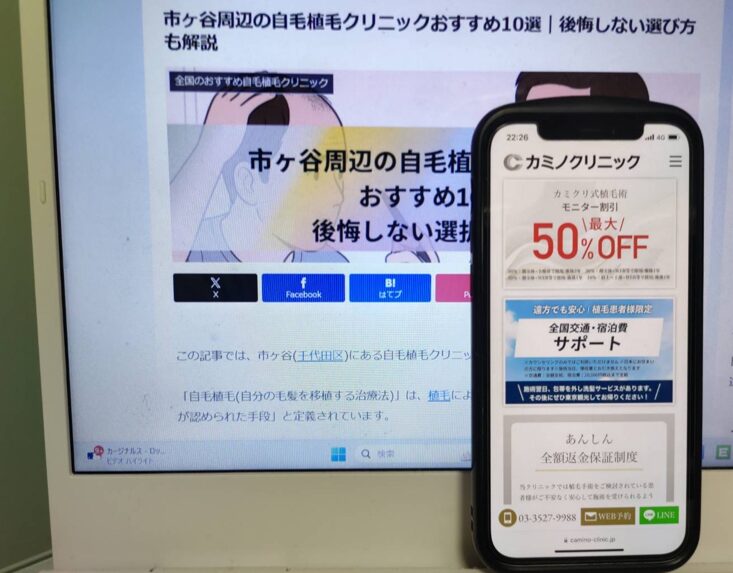 市ヶ谷周辺の自毛植毛クリニックおすすめ10選｜後悔しない選び方も解説