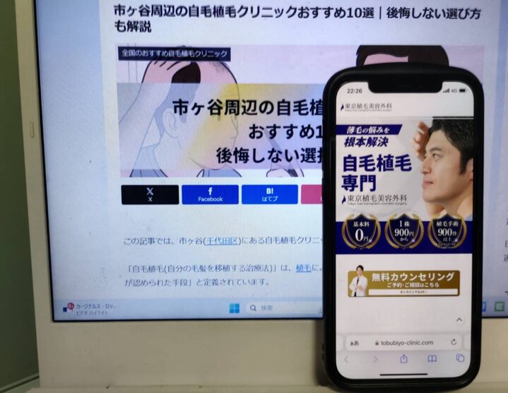 市ヶ谷周辺の自毛植毛クリニックおすすめ10選｜後悔しない選び方も解説