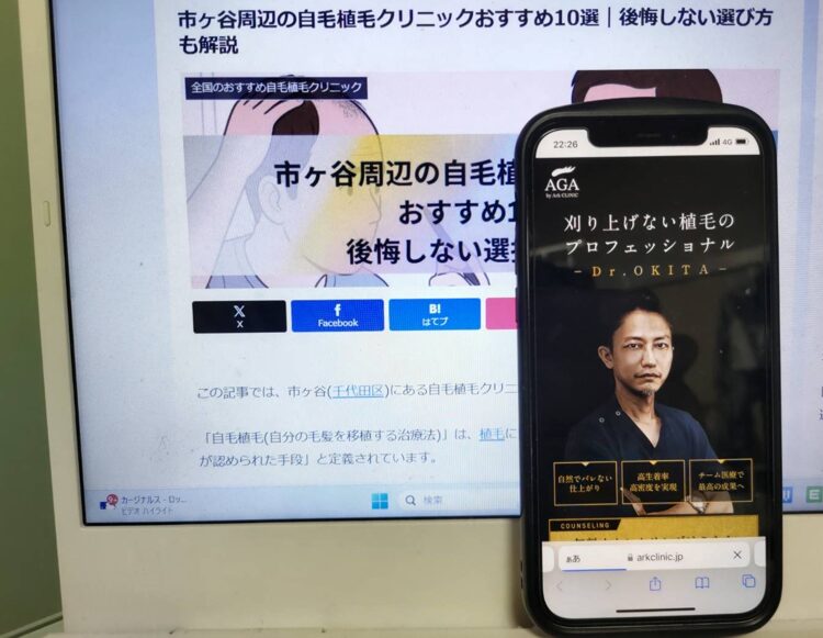 市ヶ谷周辺の自毛植毛クリニックおすすめ10選｜後悔しない選び方も解説