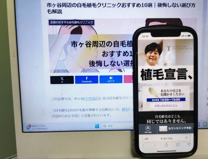 市ヶ谷周辺の自毛植毛クリニックおすすめ10選｜後悔しない選び方も解説