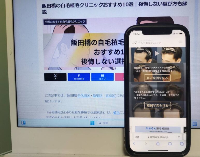 飯田橋の自毛植毛クリニックおすすめ10選｜後悔しない選び方も解説