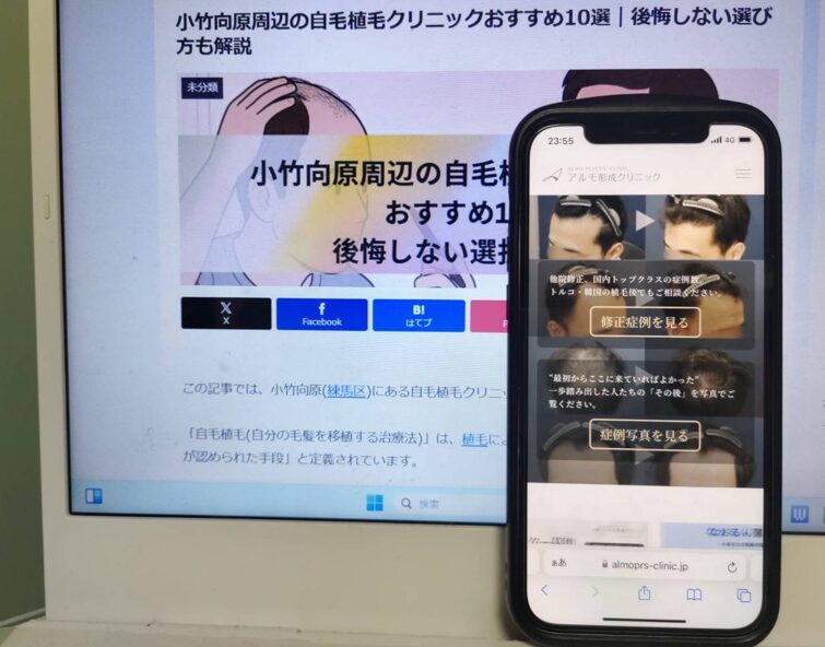 小竹向原周辺の自毛植毛クリニックおすすめ10選｜後悔しない選び方も解説