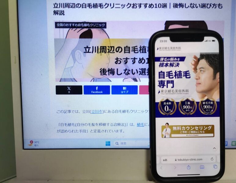 立川周辺の自毛植毛クリニックおすすめ10選｜後悔しない選び方も解説