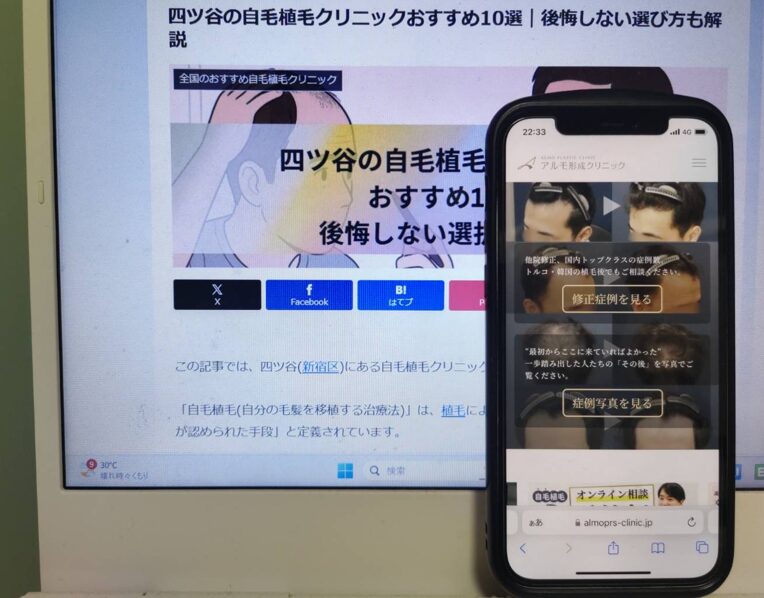 四ツ谷の自毛植毛クリニックおすすめ10選｜後悔しない選び方も解説
