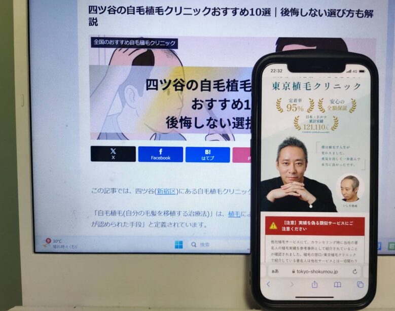 四ツ谷の自毛植毛クリニックおすすめ10選｜後悔しない選び方も解説