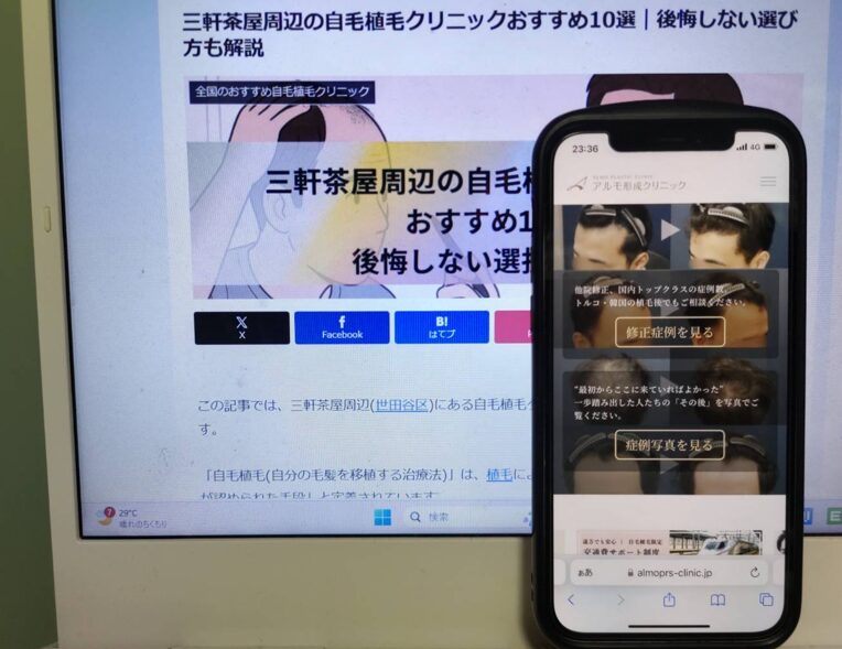 三軒茶屋周辺の自毛植毛クリニックおすすめ10選｜後悔しない選び方も解説