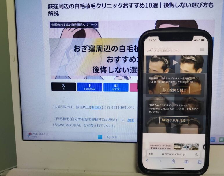 荻窪周辺の自毛植毛クリニックおすすめ10選｜後悔しない選び方も解説