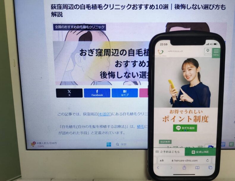 荻窪周辺の自毛植毛クリニックおすすめ10選｜後悔しない選び方も解説