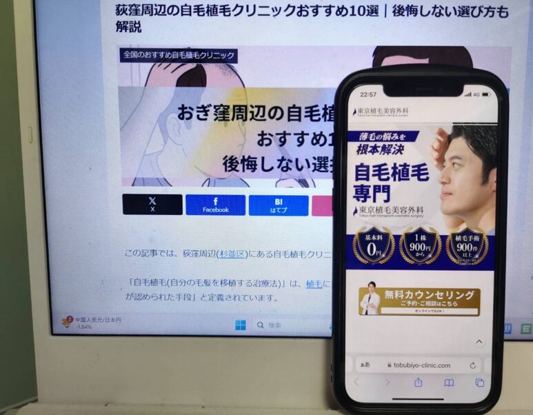 荻窪周辺の自毛植毛クリニックおすすめ10選｜後悔しない選び方も解説