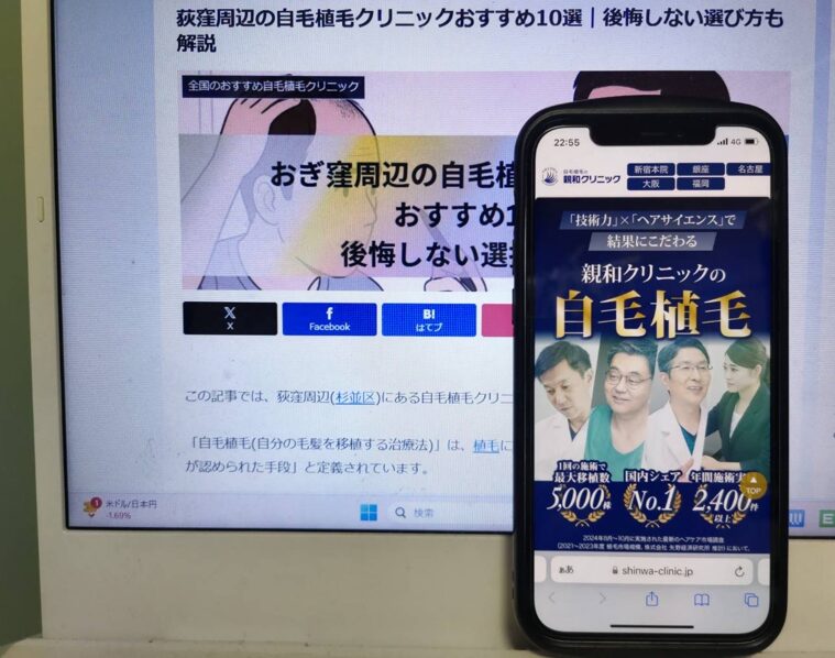 荻窪周辺の自毛植毛クリニックおすすめ10選｜後悔しない選び方も解説