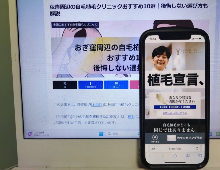 荻窪周辺の自毛植毛クリニックおすすめ10選｜後悔しない選び方も解説