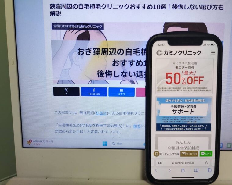 荻窪周辺の自毛植毛クリニックおすすめ10選｜後悔しない選び方も解説