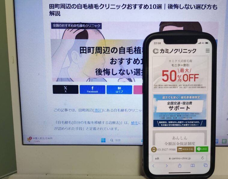 田町周辺の自毛植毛クリニックおすすめ10選｜後悔しない選び方も解説
