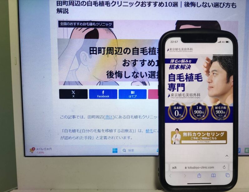田町周辺の自毛植毛クリニックおすすめ10選｜後悔しない選び方も解説