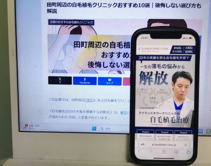 田町周辺の自毛植毛クリニックおすすめ10選｜後悔しない選び方も解説